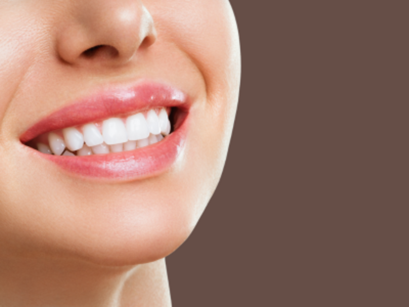 Blanchiment dentaire 